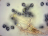 Russula fellea Gallentäubling