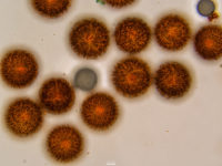 Elaphomyces granulatus - Warzige Hirschtrüffel